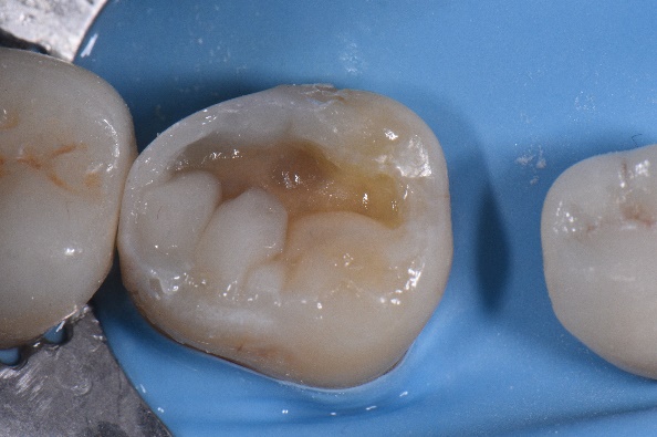 A group of buns on a blue surface

Description automatically generated with low confidence